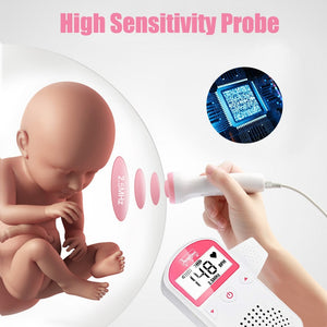 Fetal Heart Beat Monitor - Find Epic Store