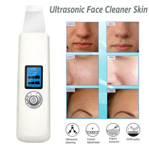 Fashion Ultrasonic Skin Scrubber Deep Face Cleaning Machine Peeling Shovel Facial Pore Cleaner Face Skin Scrubber Lift Machine - 200192143 Find Epic Store