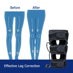 Medical-grade Leg Care Auxiliary Leg Correction Tool Both For Children & Adult Inflatable Elastic Bandage For X And O Leg Braces - 200001427 Find Epic Store