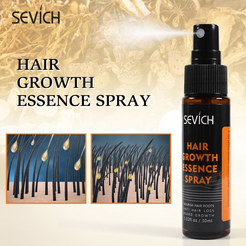 Sevich Ginger Fast Hair Growth Spray Anti Preventing Hair Loss Liquid Damaged Hair Repair Growing Spray Anti-Loss Hair Treatment - 200001174 Find Epic Store