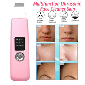 Fashion Ultrasonic Skin Scrubber Deep Face Cleaning Machine Peeling Shovel Facial Pore Cleaner Face Skin Scrubber Lift Machine - 200192143 Find Epic Store