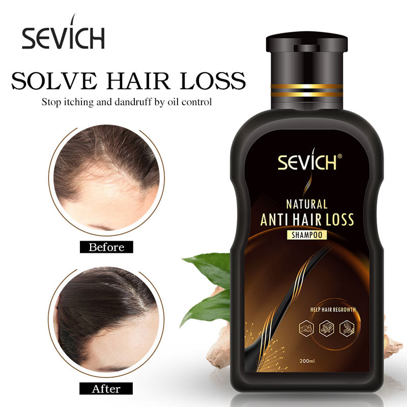 Sevich 200ml Anti Hair Loss Shampoo for hair loss treatment ginger natural hair growth cinnamon Hair Regrowth No Side Effects - 200001173 Find Epic Store