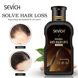 Sevich 200ml Anti Hair Loss Shampoo for hair loss treatment ginger natural hair growth cinnamon Hair Regrowth No Side Effects - 200001173 Find Epic Store
