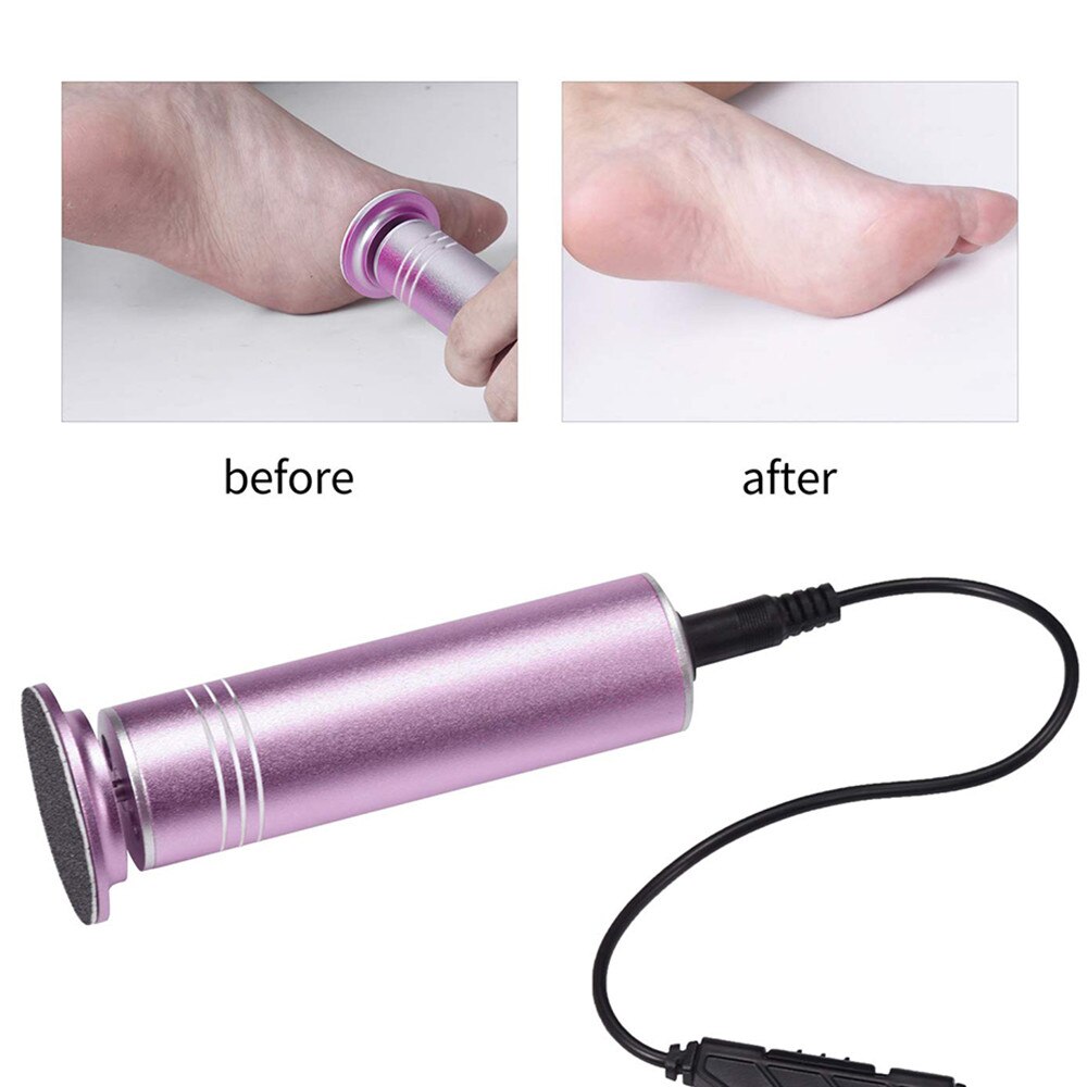 Electric Foot Grinder Multifunctional Foot Grinding Machine Exfoliating Dead Skin Callus Remover Foot Care Pedicure Device 12W - 200001297 Find Epic Store