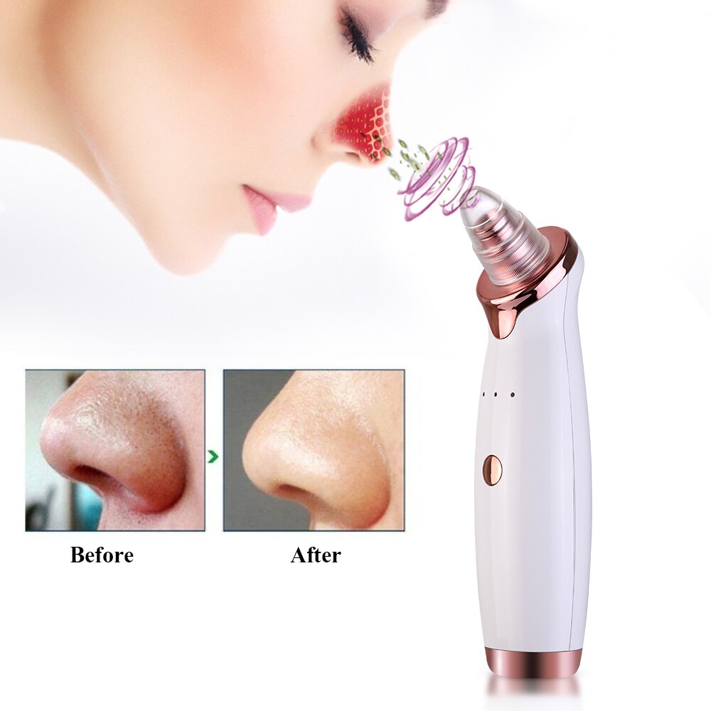 Electric Vacuum Suction Blackhead Remover USB Rechargeable Facial Pore Cleaner Spot Acne Pimple Black Head Extractor Face Care - 200192143 Find Epic Store