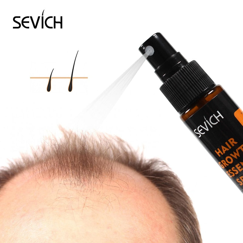 Sevich 30ml Ginger Essential Fast Hair Growth Serum Spray Anti Hair Loss Liquid Repair Damaged Hair Growing Spray - 200001174 Find Epic Store