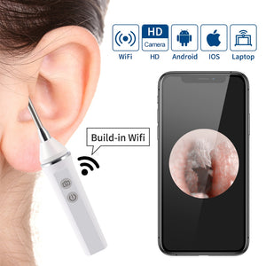 3.9 mm Wireless Ear Endoscope Medical Earwax Removal Cleaner Ultra-Thin Ear Scope with Camera Android iOS Ear Otoscop Pick Spoon - 200364159 Find Epic Store
