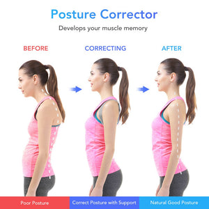 Smart Back Posture Corrector Adjustable Posture Correction Belt Intelligent Upper Back Support Brace Clavicle Prevent Slouching - 200001427 Find Epic Store