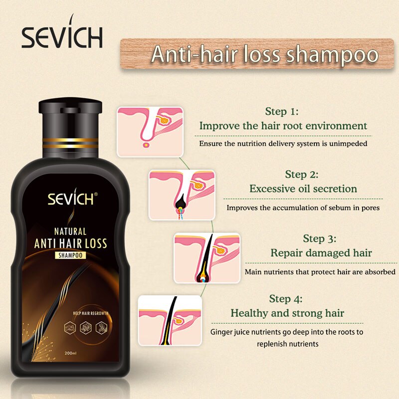 Sevich 200ml Anti Hair Loss Shampoo for hair loss treatment ginger natural hair growth cinnamon Hair Regrowth No Side Effects - 200001173 Find Epic Store