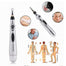 Electronic Acupuncture Pen - Find Epic Store