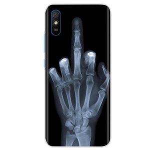 Soft Silicone Case For Xiaomi Redmi 9A Case Soft TPU Fundas Phone Case For Xiaomi Redmi 9A Redmi9A 9 A Case Back Cover Shell - Color 19 Find Epic Store